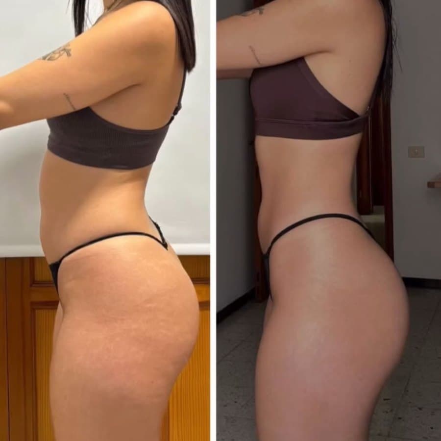 Cambio físico logrado con el Método Mutation (14 de 34)