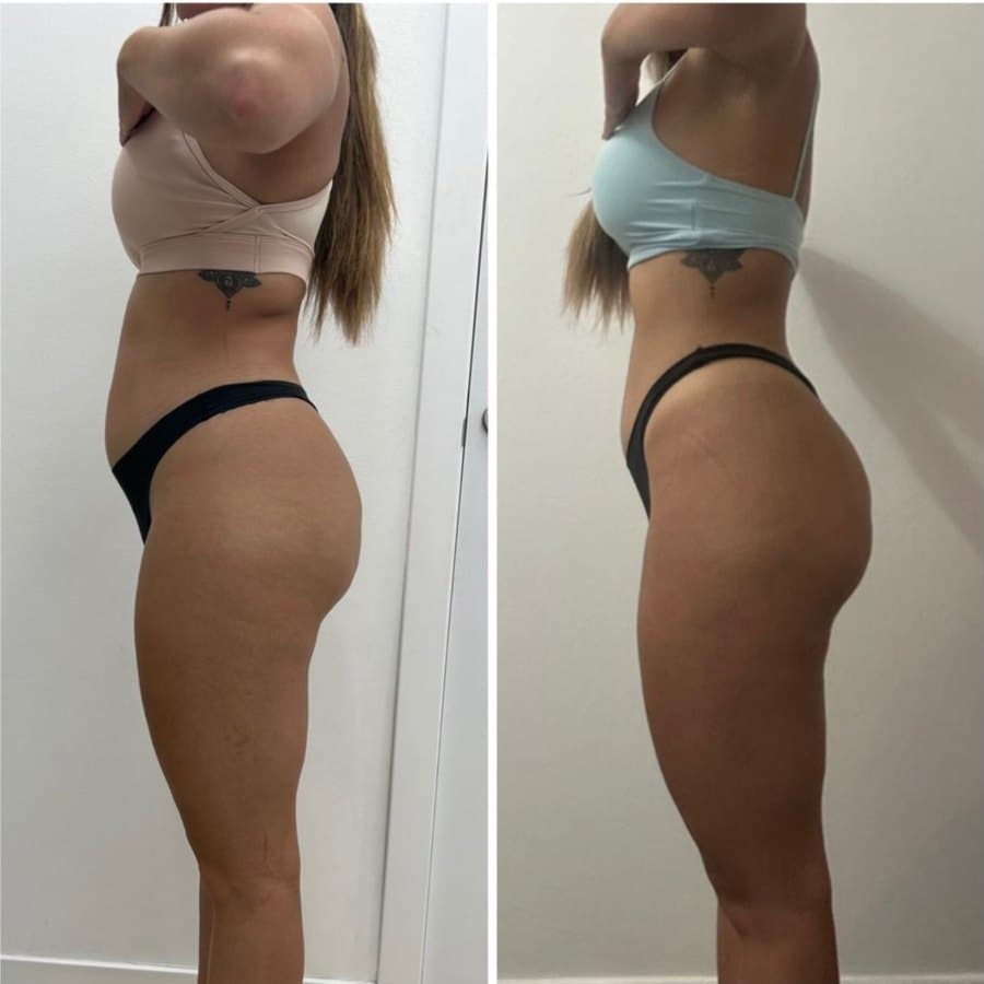 Cambio físico logrado con el Método Mutation (34 de 34)
